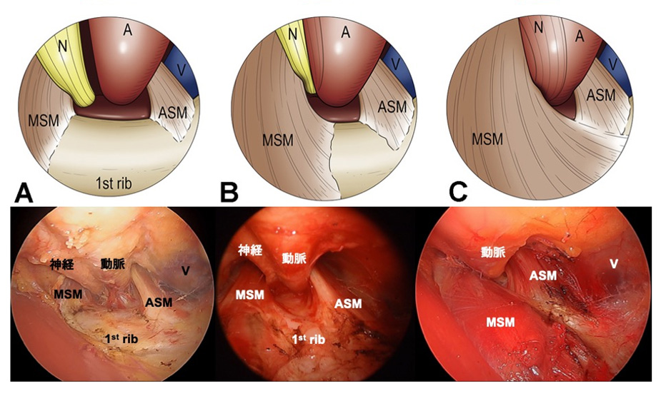 数多くの手術経験より、近年わかってきたこと