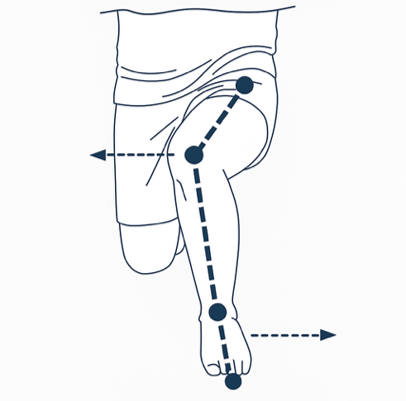 図2 knee-in toe out